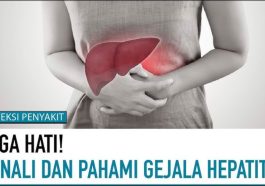 Kenali Cara Cegah Hepatitis Sejak Dini, Gejala Awal hingga Obat yang di Konsumsi