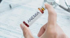 Anemia