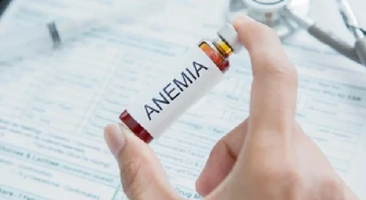 Anemia