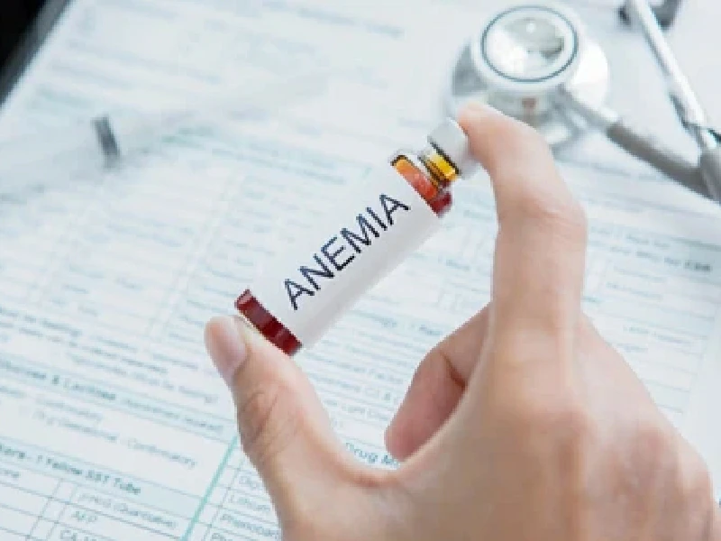 Anemia
