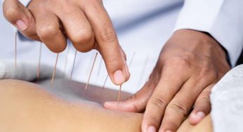 Manfaat Akupunktur untuk Mengurangi Nyeri Kronis