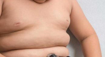 Obesitas Anak Meningkat: Siapa yang Bertanggung Jawab?