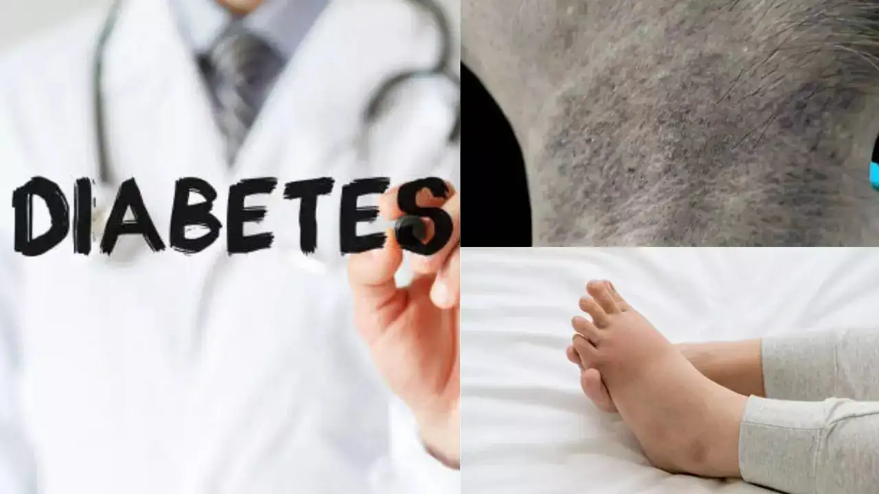 Tanda Awal Diabetes