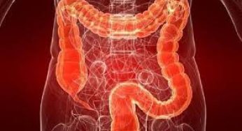 Waspada Sumbatan Usus, Pelajari Gejalanya dari Kasus yang Menimpah Ayah Jerome Polin